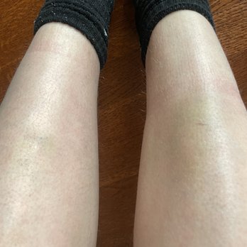 Radius - Security was pushing and being obnoxious. These are from them. - Music Venues Near Me - Chicago, Illinois