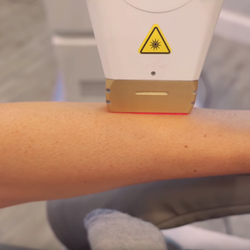 Sculpted Med Spa & Cryotherapy Center - Laser Hair Removal