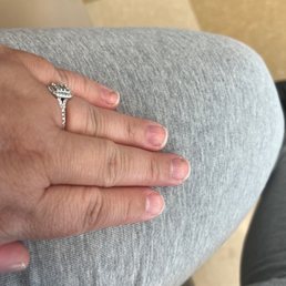 Fungus growth in 2 of my fingers Fungus growth in 2 of my fingers