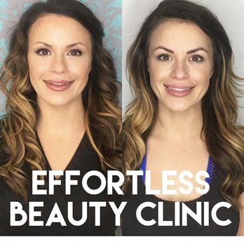 Effortless Beauty Clinic - Before and after 4 weeks apart - Permanent Makeup Near Me