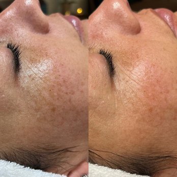 SkinH2O - Skin Care Near Me - Hillsboro, Oregon SkinH2O - Skin Care Near Me - Hillsboro, Oregon