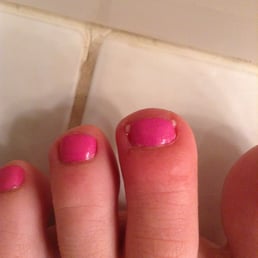 Infection day after visiting salon.  Puss coming out of both corners of the nail.  AVOID THIS PLACE LIKE THE PLEGUE!
