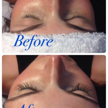 Stella Mar - Before & After - Skin Care Near Me - Honolulu, Hawaii Stella Mar - Before & After - Skin Care Near Me - Honolulu, Hawaii