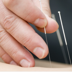 Jung Acupuncture & Herbal Clinic - Best Acupuncturist in town!