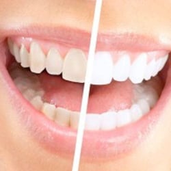 Dentistry At Bayview Glen - At the Dentistry at Bayview Glen we help our patients maintain optimal dental health by educating them on how to develop heal...