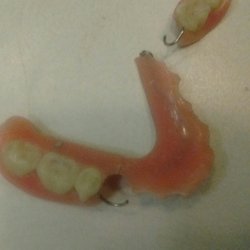 Karpovck Mark,DMD - This is the kind of work they do, buyer beware!
