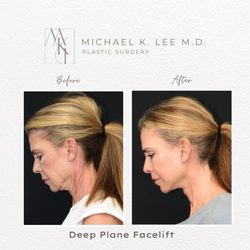 Michael K Lee, MD - Patient