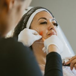 Finesse Med Spa & Wellness - Dermal Filler Treatment