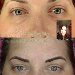 Before and after front view