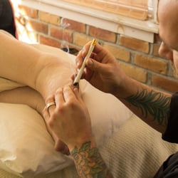 Brooklyn Acupuncture Project - As you approach the clinic you may smell Mugwort. Moxabustion is the technique of burning Mugwart over acupuncture points.