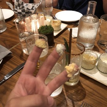 Group Therapy - From left to da right... hummus feta and pimento. Three delicious dips. Wish I could say the same about me kids - Wine Bars Near Me - Austin, Texas