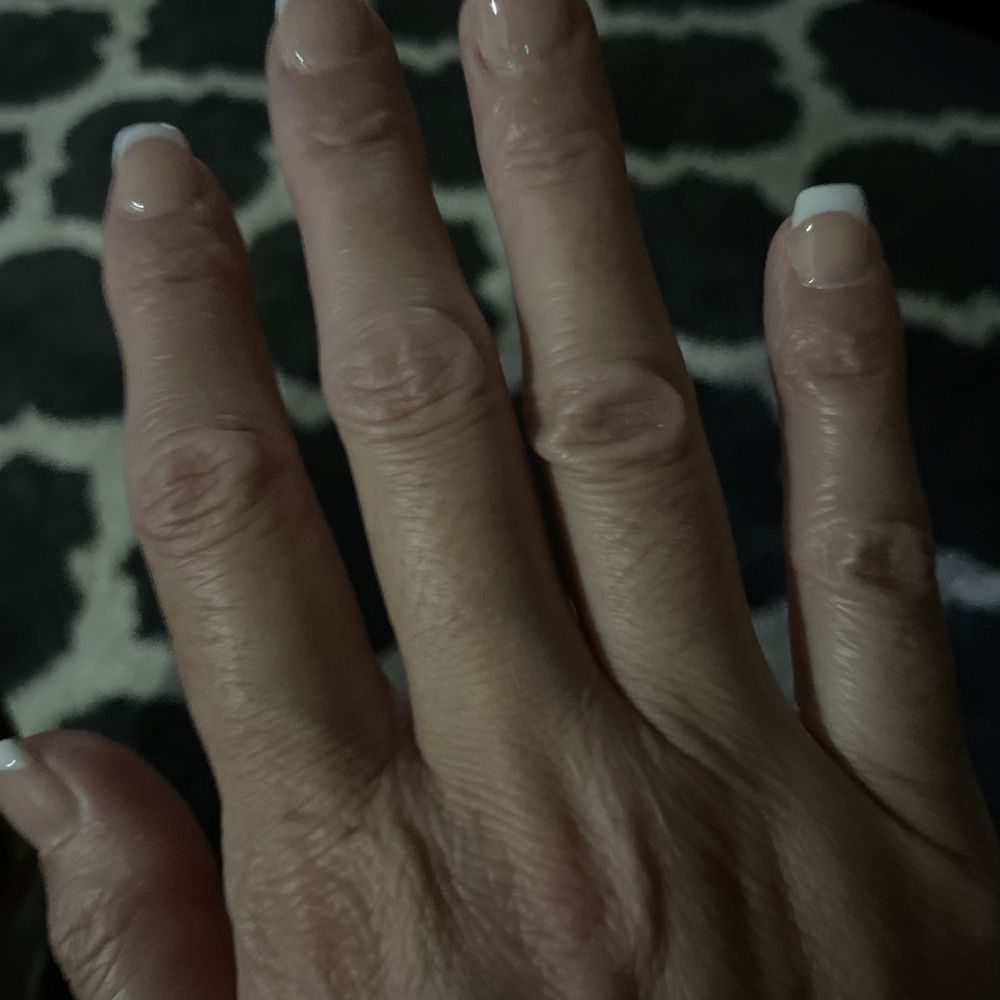 Gel overlay nails