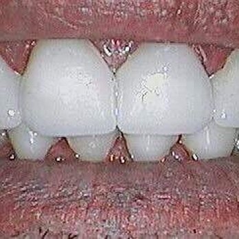 Parish Family Dental - General Dentistry Near Me - Carmichael, California
