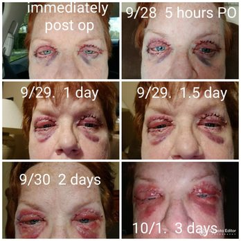 Sono Bello - Cosmetic Surgeons Near Me - Orlando, Florida