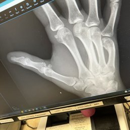 First x ray First x ray