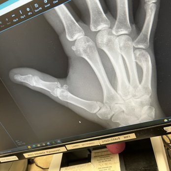 Hand Surgery Specialists - First x ray - Surgeons Near Me - Houston, Texas Hand Surgery Specialists - First x ray - Surgeons Near Me - Houston, Texas