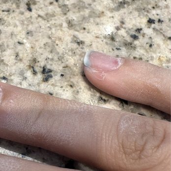 Lee's Spa Nail - side view to show elevation difference in my nail where she burnt a chunk off - Nail Salons Near Me - Monroe, North Carolina