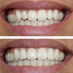 Smile Win Dental - Grapevine - Smile Win Dental - Grapevine