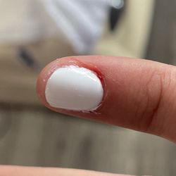They cut me