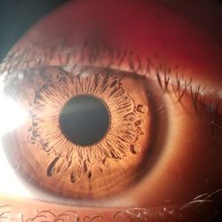 National City Eyecare