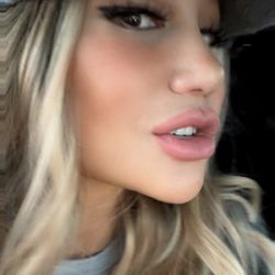 You can't even see the stitches. 2 weeks post op Barbie nose.