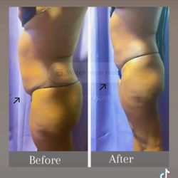 YaYa & Friends - Body Contouring 6 sessions!