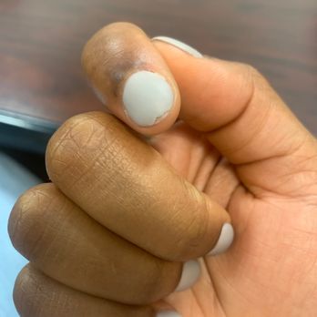 Shape of Nails - Chipped nail after 4 days - Nail Salons Near Me - Reston, Virginia