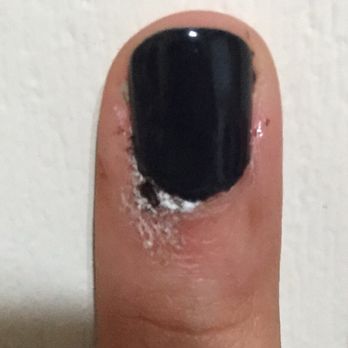 Herbal Nails & Spa - What my finger looked like after the manicure was done . - Massage Near Me - Houston, Texas