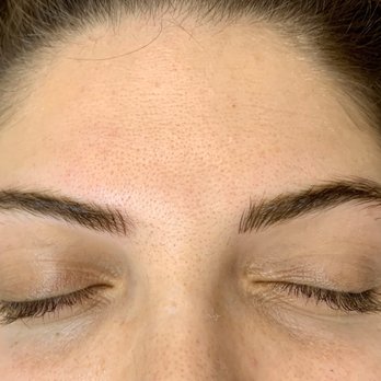 Leblanc Day Spa - After photo! - Skin Care Near Me - Walnut Creek, California Leblanc Day Spa - After photo! - Skin Care Near Me - Walnut Creek, California