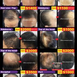 Sharon Permanent Makeup - Buena Park - Get ready for the BIGGEST HAIR LOSS
COVER sale of the year!
* 80% OFF our best-selling solution
* Experience the latest technique!