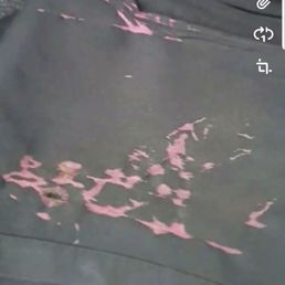 This was the damage to all my clothes!! This was the damage to all my clothes!!