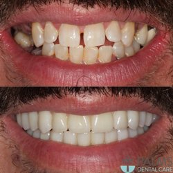 Palms Dental Care