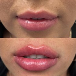 Bella Rosa Skin Rejuvenation Clinic
