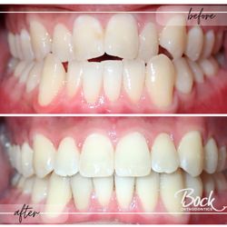 Bock Orthodontics