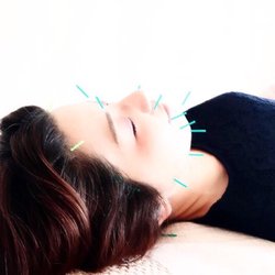 Casa Zen Acupuncture - Cosmetic Acupuncture