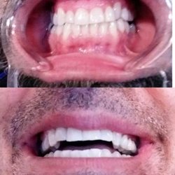 White Obsession - Whiter Teeth, Brighter Smiles