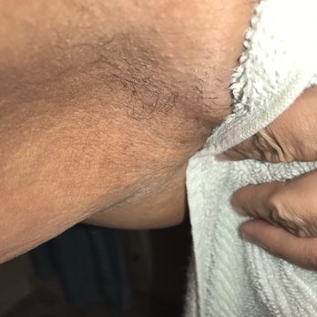 Bollywood Spas - Random patch of hair left.  There are more but it would inappropriate to share. - Threading Services Near Me - Corona, California