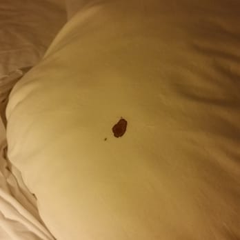 Best Western Apricot Inn - Blood stained pillow, yuck! - Hotels Near Me - Firebaugh, California Best Western Apricot Inn - Blood stained pillow, yuck! - Hotels Near Me - Firebaugh, California
