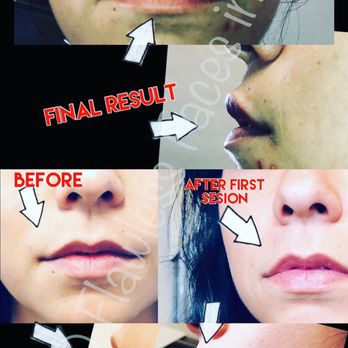 Flawless Faces Ink - Lip Filler - Permanent Makeup Near Me - Oroville, California Flawless Faces Ink - Lip Filler - Permanent Makeup Near Me - Oroville, California