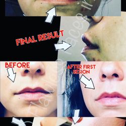 Flawless Faces Ink - Lip Filler
