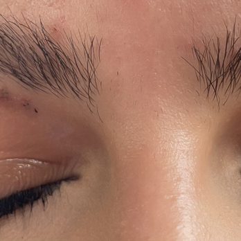 Vip Nails & Spa - Burned skin!!! - Nail Salons Near Me - Ballwin, Missouri