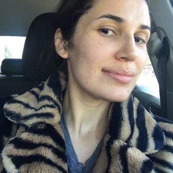 Ava MD - And e other side of my clear perfect skin, and I don't even really up keep as well as I could. - Dermatologists Near Me - Santa Monica, California
