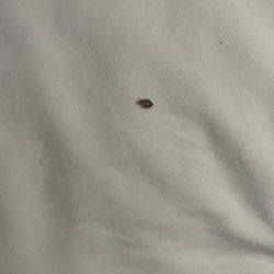 AmericInn by Wyndham Wahpeton - Bed bug.