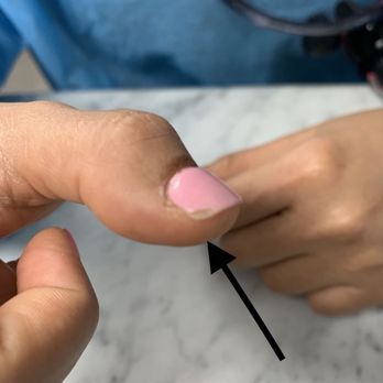 JM Nail & Spa - Chipped nail - Day Spas Near Me - Plantation, Florida JM Nail & Spa - Chipped nail - Day Spas Near Me - Plantation, Florida