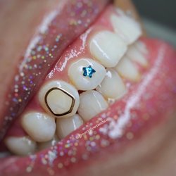 Groovy Glow Teeth Whitening
