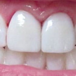 Smiles by Dr. Anna - Milford Dentist
SMILES BY DR. ANNA
67 CHERRY ST STE C-2
MILFORD CT 06460
http://mymilforddentist.com/