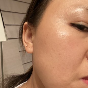 Skin Solutions - Skin Care Near Me - Flushing, New York Skin Solutions - Skin Care Near Me - Flushing, New York