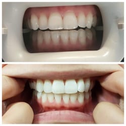 Impressions The Dental Hygiene Spa