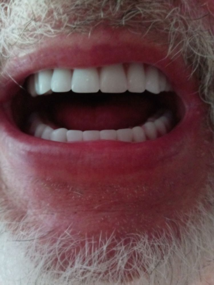 AFFORDABLE DENTURES Updated October 2024 16374 Hotchkiss Valley Rd