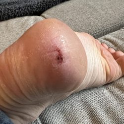 Grand Nails & Spa - Update 4/16 (3 days later). Still SO painful and keeps bleeding Have to tip toe